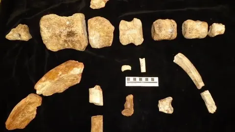 conjunto de v&eacute;rtebras, costillas y otros